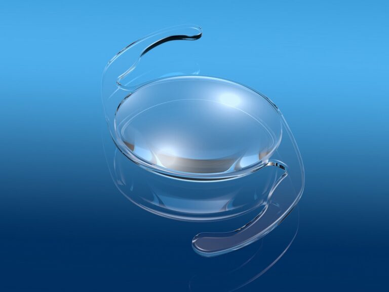 Medically illustration showing intraocular lens (IOL)